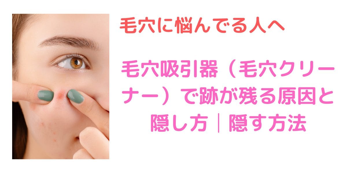 毛穴吸引器（毛穴クリーナー）で跡が残る原因と隠し方│隠す方法