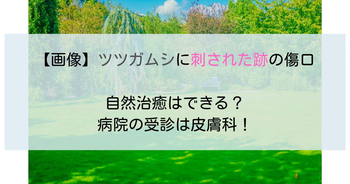 【画像】ツツガムシに刺された跡の傷口│自然治癒できる？受診は皮膚科！