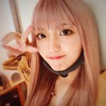 【衝撃画像】ネオがアナフィラキシーショックで顔が真っ赤に腫れる!「私の一命は危うかった」